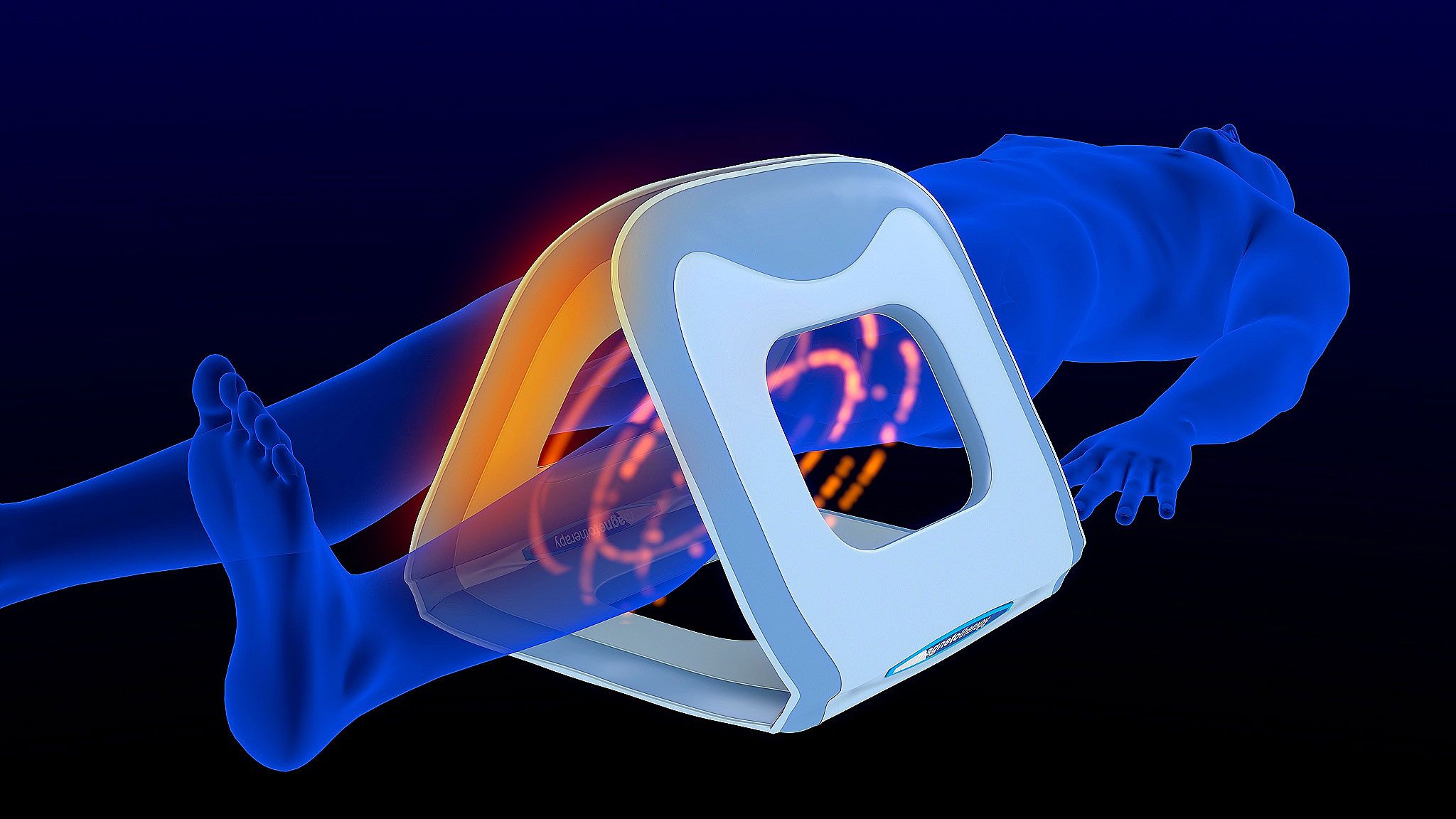 Pulsed electromagnetic field therapy