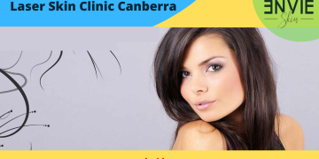 laser skin clinic in Canberra