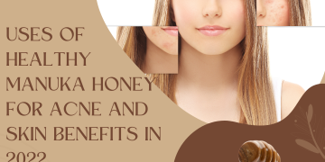 Healthy Manuka Honey for Acne and Skin Benefits