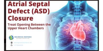 Atrial-Septal-defect
