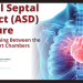 Atrial-Septal-defect