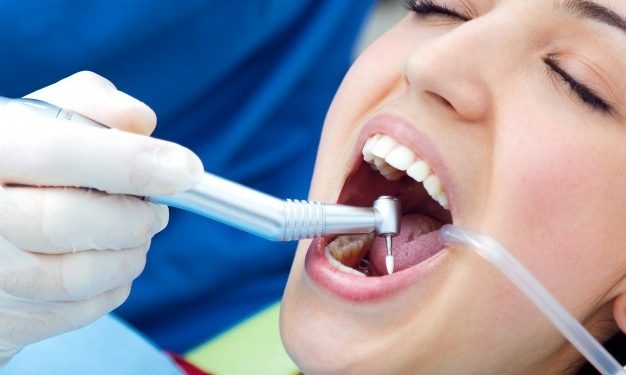 teeth filling services